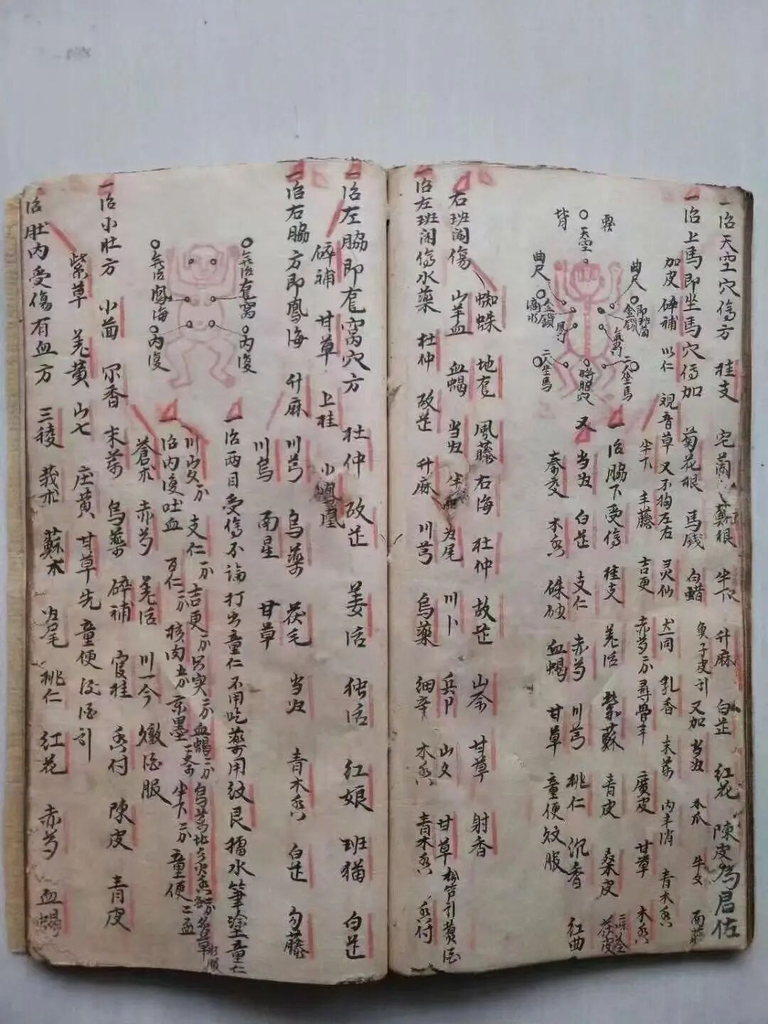 清代名师手抄秘本《大打丸药驳骨总方》百道跌打正骨良方(3)