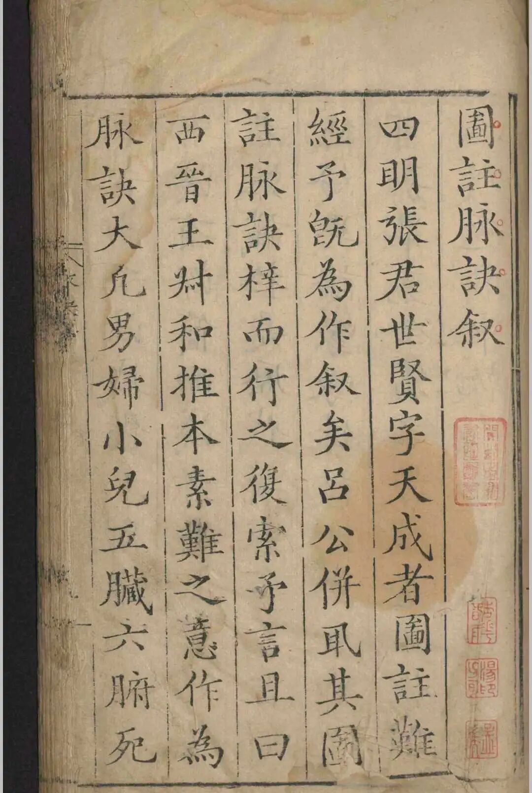 明嘉靖原版《图注王叔和脉诀》，张世贤全图注解，附方一卷，古中医脉诊经典(2)