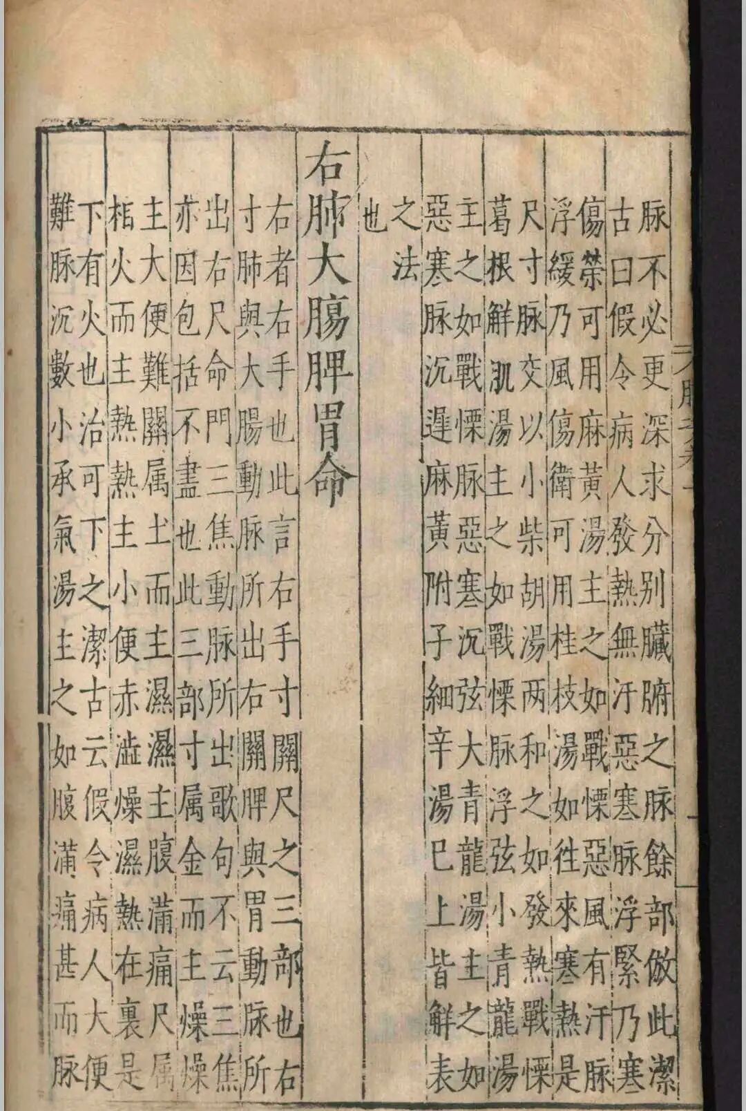 明嘉靖原版《图注王叔和脉诀》，张世贤全图注解，附方一卷，古中医脉诊经典(10)
