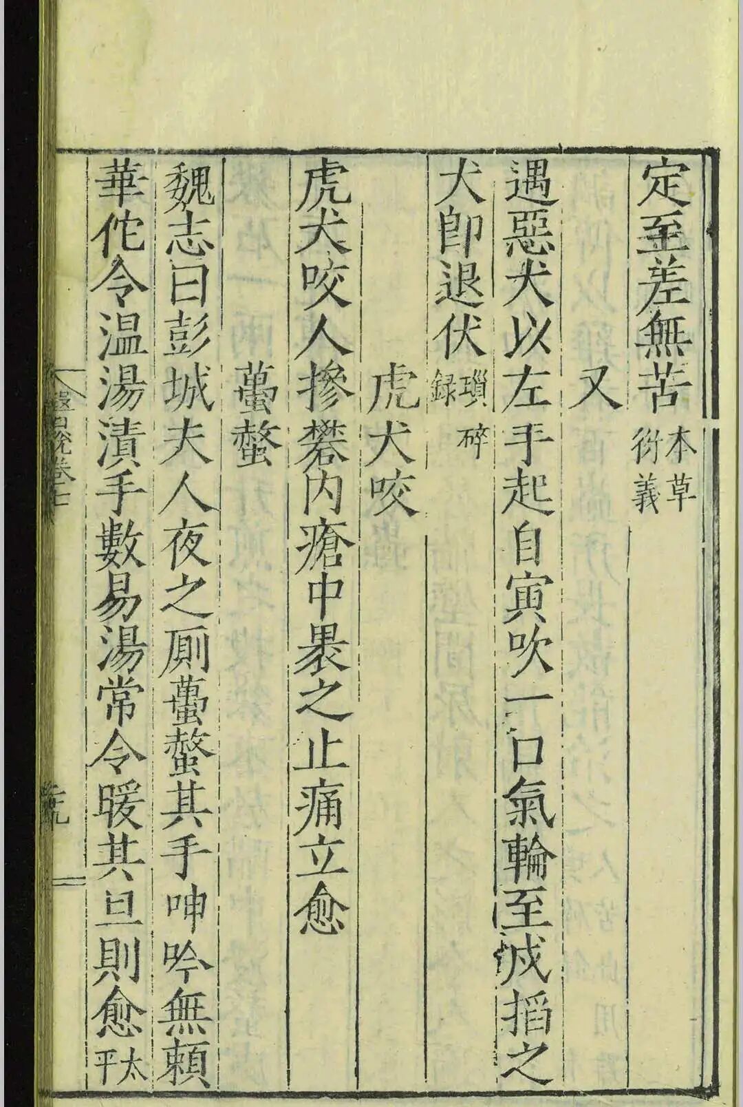 嘉靖二十三年官刻善本《医说》,新安医家传世医话医案古籍(9) 嘉靖二十三年官刻善本《医说》,新安医家传世医话医案古籍(9)