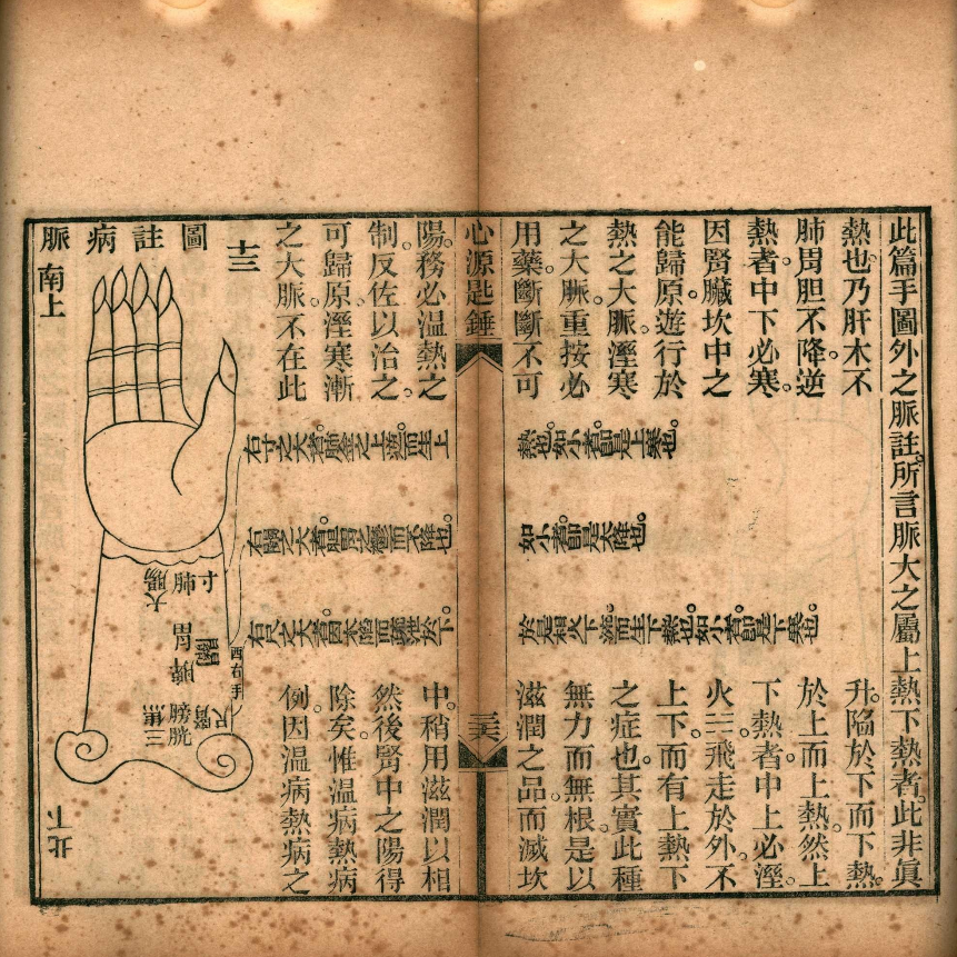清光绪刊本《心源匙锤》,徐公桓撰脏腑经络医论古籍(9) 清光绪刊本《心源匙锤》,徐公桓撰脏腑经络医论古籍(9)