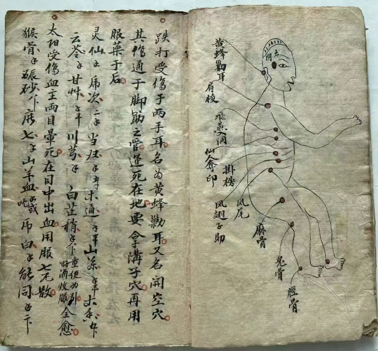探秘中医跌打秘本:五百钱点解穴秘传(6) 探秘中医跌打秘本:五百钱点解穴秘传(6)